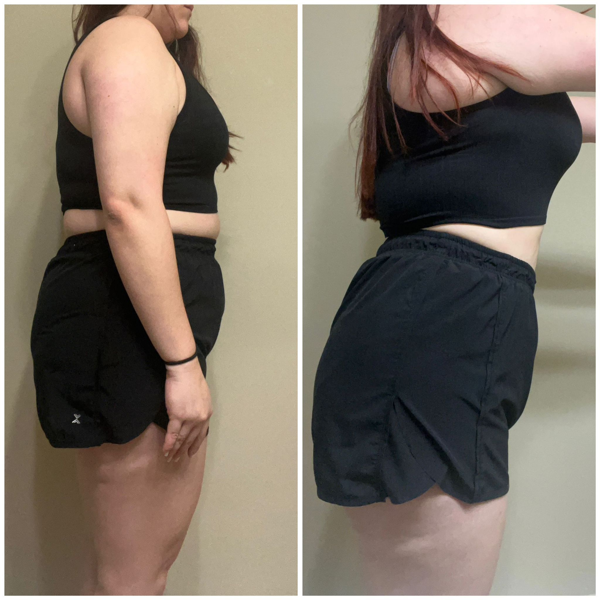 Before After photo 9