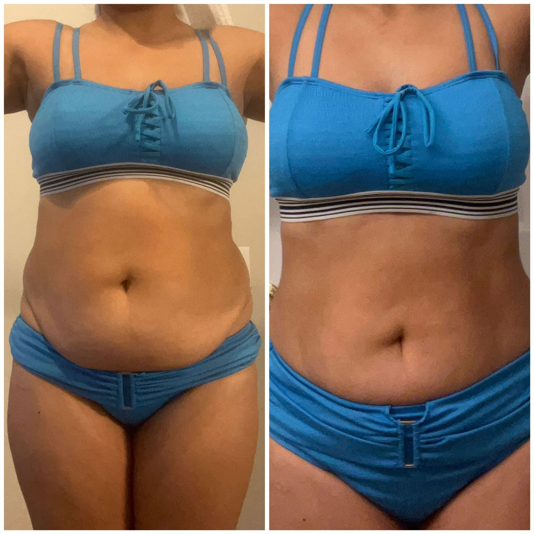 Before After photo 15